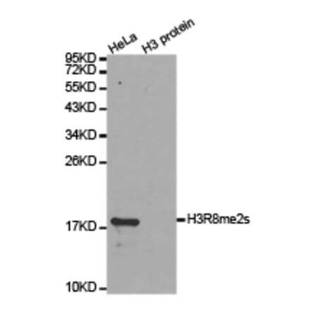 Western blot - Histone H3R8me2s Polyclonal Antibody from Signalway Antibody (HW015) - Antibodies.com