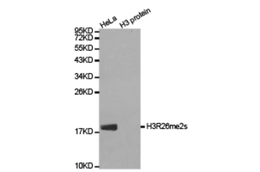 Western blot - Histone H3R26me2s Polyclonal Antibody from Signalway Antibody (HW021) - Antibodies.com