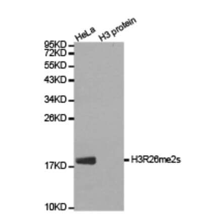 Western blot - Histone H3R26me2s Polyclonal Antibody from Signalway Antibody (HW021) - Antibodies.com