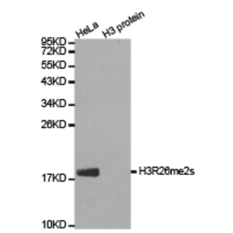 Western blot - Histone H3R26me2s Polyclonal Antibody from Signalway Antibody (HW021) - Antibodies.com