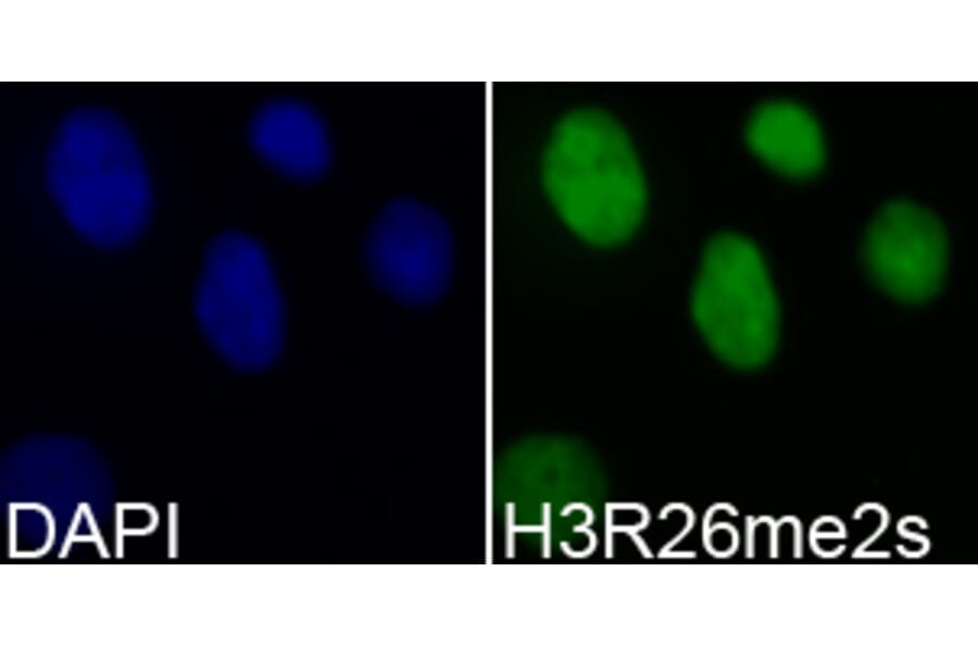 Immunofluorescence - Histone H3R26me2s Polyclonal Antibody from Signalway Antibody (HW021) - Antibodies.com