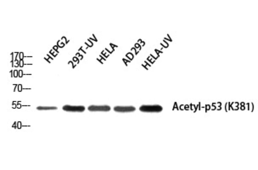 Western blot - p53 (Acetyl-Lys381) Polyclonal Antibody from Signalway Antibody (HW109) - Antibodies.com