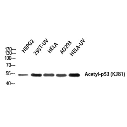 Western blot - p53 (Acetyl-Lys381) Polyclonal Antibody from Signalway Antibody (HW109) - Antibodies.com