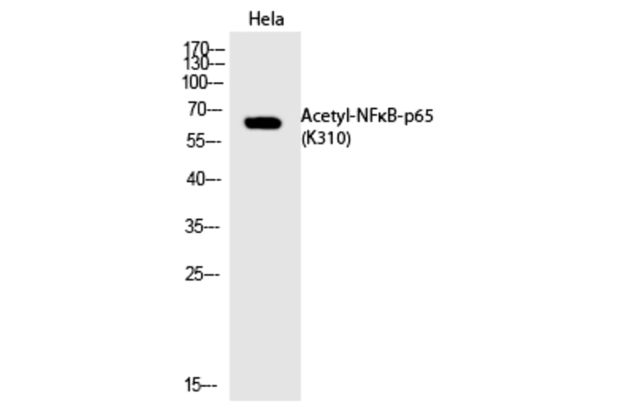 Western blot - NFκB-p65 (Acetyl-Lys310) Polyclonal Antibody from Signalway Antibody (HW110) - Antibodies.com