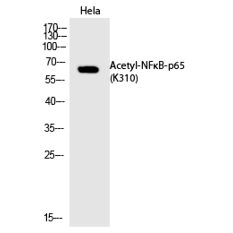 Western blot - NFκB-p65 (Acetyl-Lys310) Polyclonal Antibody from Signalway Antibody (HW110) - Antibodies.com