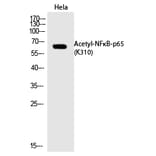 Western blot - NFκB-p65 (Acetyl-Lys310) Polyclonal Antibody from Signalway Antibody (HW110) - Antibodies.com