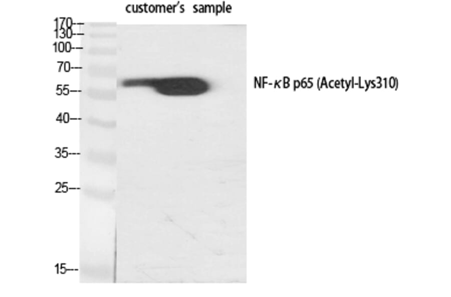 Western blot - NFκB-p65 (Acetyl-Lys310) Polyclonal Antibody from Signalway Antibody (HW110) - Antibodies.com