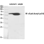 Western blot - NFκB-p65 (Acetyl-Lys310) Polyclonal Antibody from Signalway Antibody (HW110) - Antibodies.com