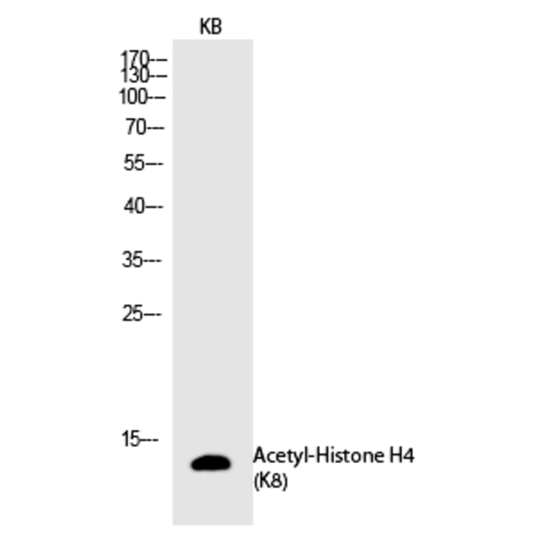 Western blot - Histone H4 (Acetyl-Lys8) Polyclonal Antibody from Signalway Antibody (HW108) - Antibodies.com