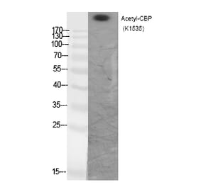 Western blot - CBP (Acetyl-Lys1535) Polyclonal Antibody from Signalway Antibody (HW111) - Antibodies.com