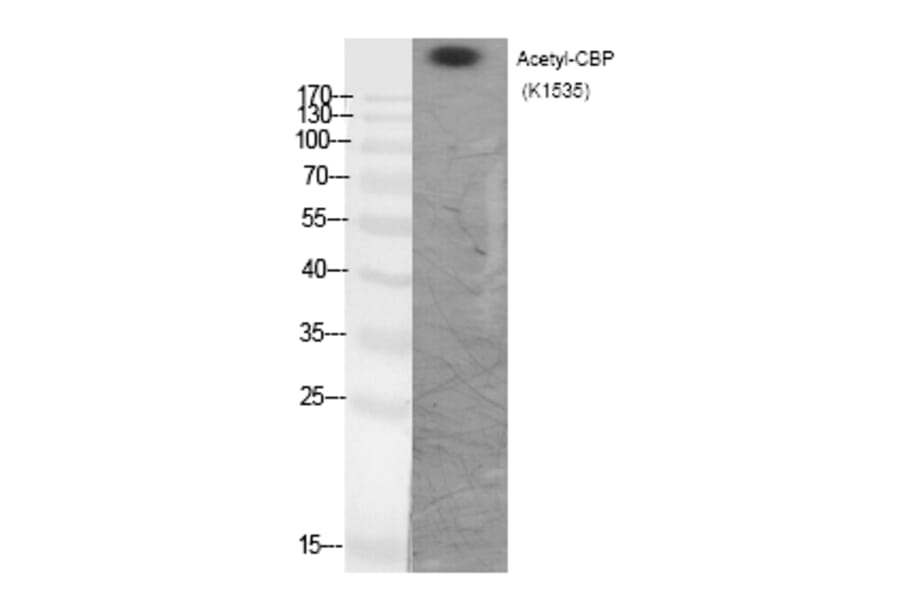 Western blot - CBP (Acetyl-Lys1535) Polyclonal Antibody from Signalway Antibody (HW111) - Antibodies.com