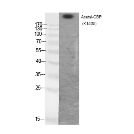 Western blot - CBP (Acetyl-Lys1535) Polyclonal Antibody from Signalway Antibody (HW111) - Antibodies.com