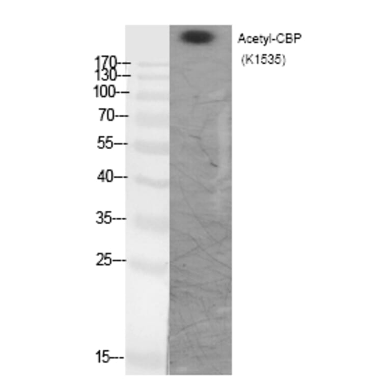 Western blot - CBP (Acetyl-Lys1535) Polyclonal Antibody from Signalway Antibody (HW111) - Antibodies.com