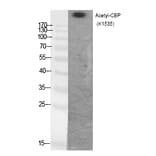 Western blot - CBP (Acetyl-Lys1535) Polyclonal Antibody from Signalway Antibody (HW111) - Antibodies.com