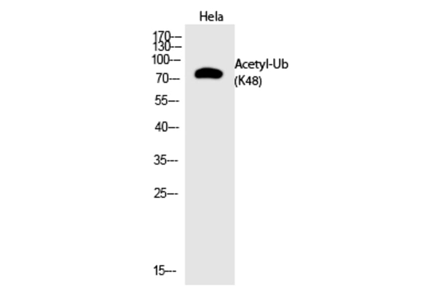 Western blot - Ub (Acetyl-Lys48) Polyclonal Antibody from Signalway Antibody (HW141) - Antibodies.com
