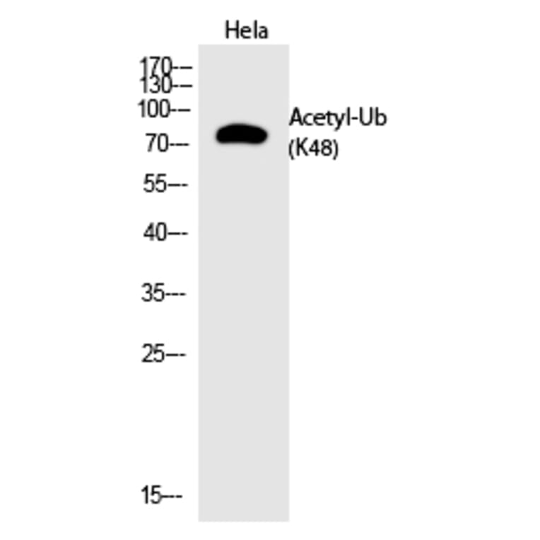 Western blot - Ub (Acetyl-Lys48) Polyclonal Antibody from Signalway Antibody (HW141) - Antibodies.com