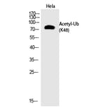 Western blot - Ub (Acetyl-Lys48) Polyclonal Antibody from Signalway Antibody (HW141) - Antibodies.com