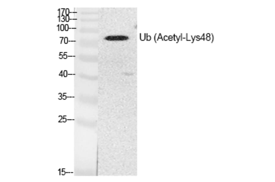 Western blot - Ub (Acetyl-Lys48) Polyclonal Antibody from Signalway Antibody (HW141) - Antibodies.com