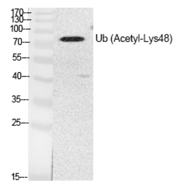 Western blot - Ub (Acetyl-Lys48) Polyclonal Antibody from Signalway Antibody (HW141) - Antibodies.com