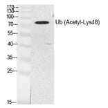 Western blot - Ub (Acetyl-Lys48) Polyclonal Antibody from Signalway Antibody (HW141) - Antibodies.com