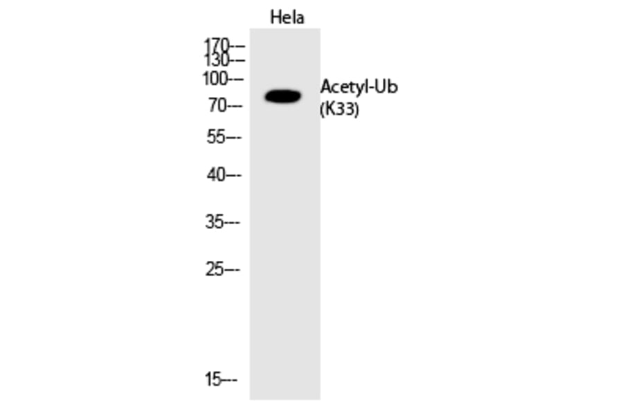Western blot - Ub (Acetyl-Lys33) Polyclonal Antibody from Signalway Antibody (HW140) - Antibodies.com