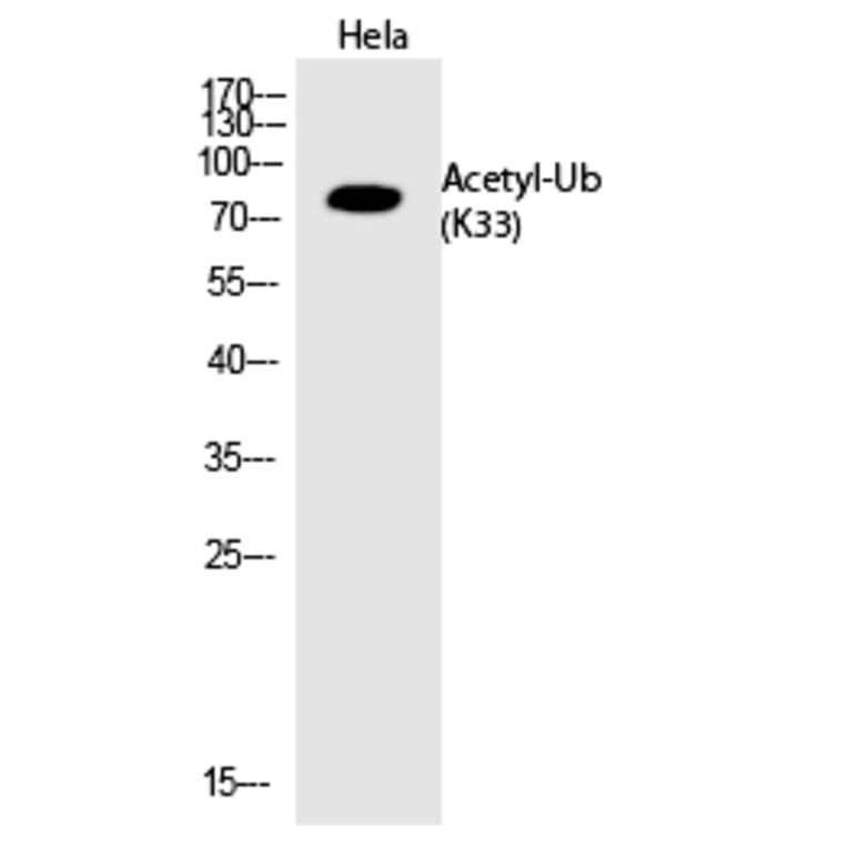 Western blot - Ub (Acetyl-Lys33) Polyclonal Antibody from Signalway Antibody (HW140) - Antibodies.com