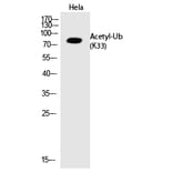 Western blot - Ub (Acetyl-Lys33) Polyclonal Antibody from Signalway Antibody (HW140) - Antibodies.com