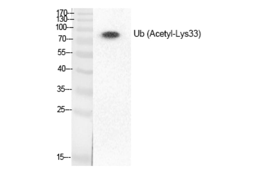 Western blot - Ub (Acetyl-Lys33) Polyclonal Antibody from Signalway Antibody (HW140) - Antibodies.com
