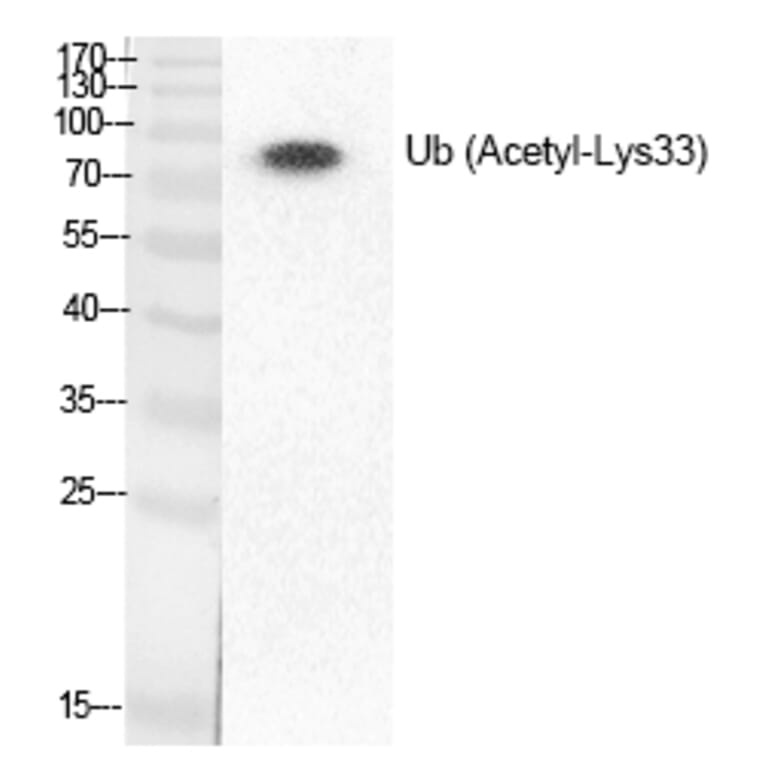 Anti-Ub (Acetyl-Lys33) Antibody (A51663) | Antibodies.com