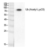 Western blot - Ub (Acetyl-Lys33) Polyclonal Antibody from Signalway Antibody (HW140) - Antibodies.com
