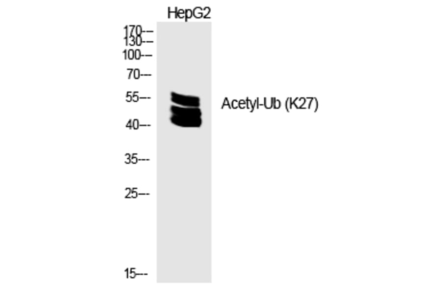 Western blot - Ub (Acetyl-Lys27) Polyclonal Antibody from Signalway Antibody (HW134) - Antibodies.com