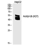 Western blot - Ub (Acetyl-Lys27) Polyclonal Antibody from Signalway Antibody (HW134) - Antibodies.com