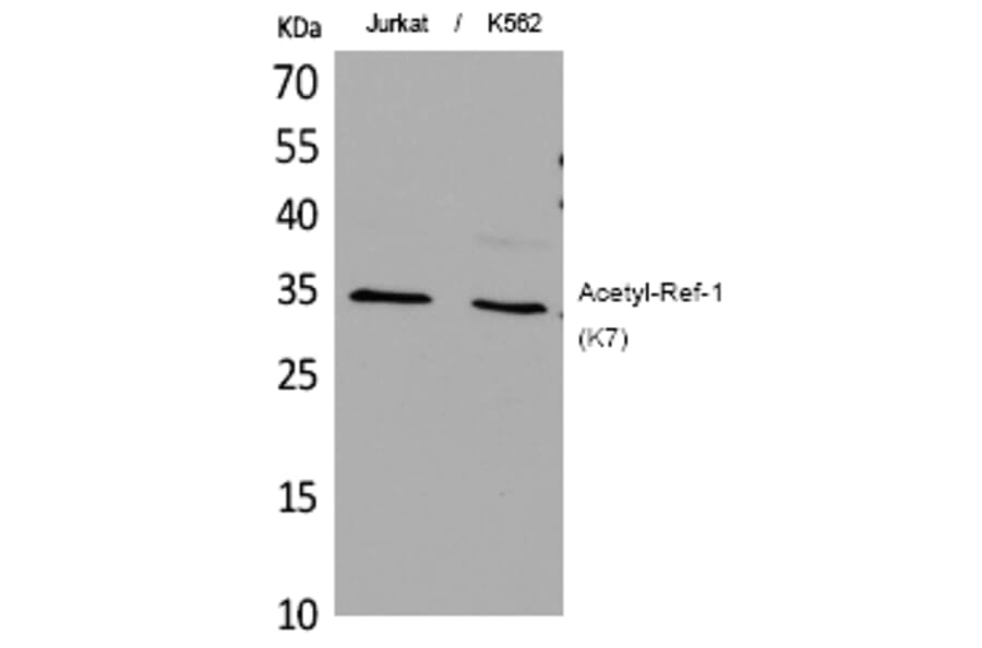 Western blot - Ref-1 (Acetyl-Lys7) Polyclonal Antibody from Signalway Antibody (HW113) - Antibodies.com