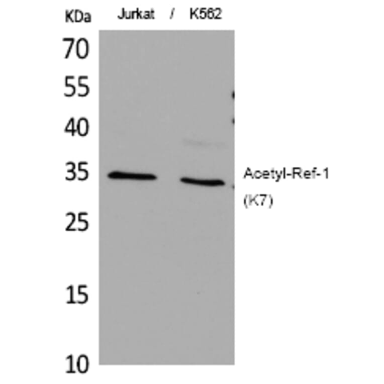 Western blot - Ref-1 (Acetyl-Lys7) Polyclonal Antibody from Signalway Antibody (HW113) - Antibodies.com