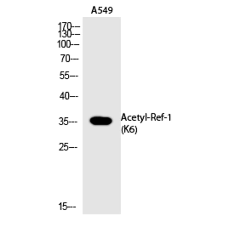 Western blot - Ref-1 (Acetyl-Lys6) Polyclonal Antibody from Signalway Antibody (HW112) - Antibodies.com