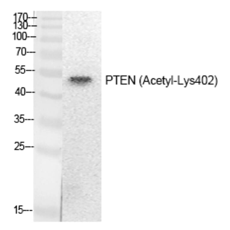 Western blot - PTEN (Acetyl-Lys402) Polyclonal Antibody from Signalway Antibody (HW139) - Antibodies.com