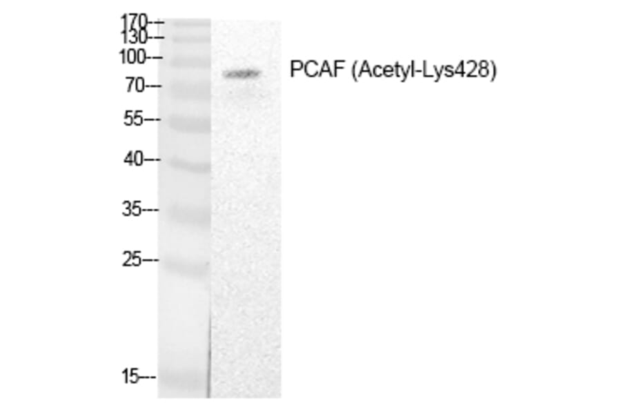 Western blot - PCAF (Acetyl-Lys428) Polyclonal Antibody from Signalway Antibody (HW138) - Antibodies.com