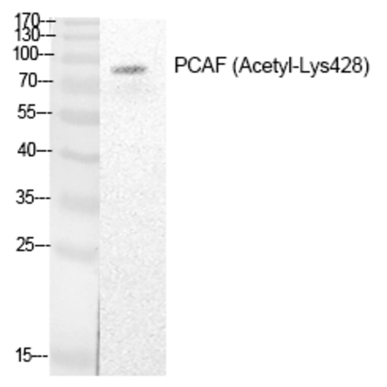 Western blot - PCAF (Acetyl-Lys428) Polyclonal Antibody from Signalway Antibody (HW138) - Antibodies.com
