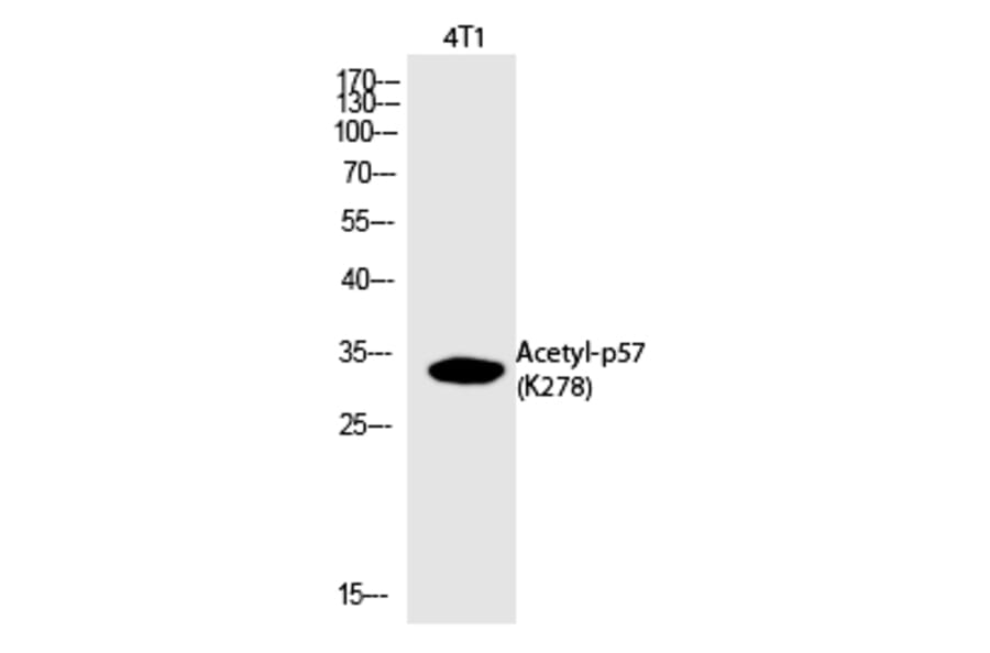 Western blot - p57 (Acetyl-Lys278) Polyclonal Antibody from Signalway Antibody (HW130) - Antibodies.com