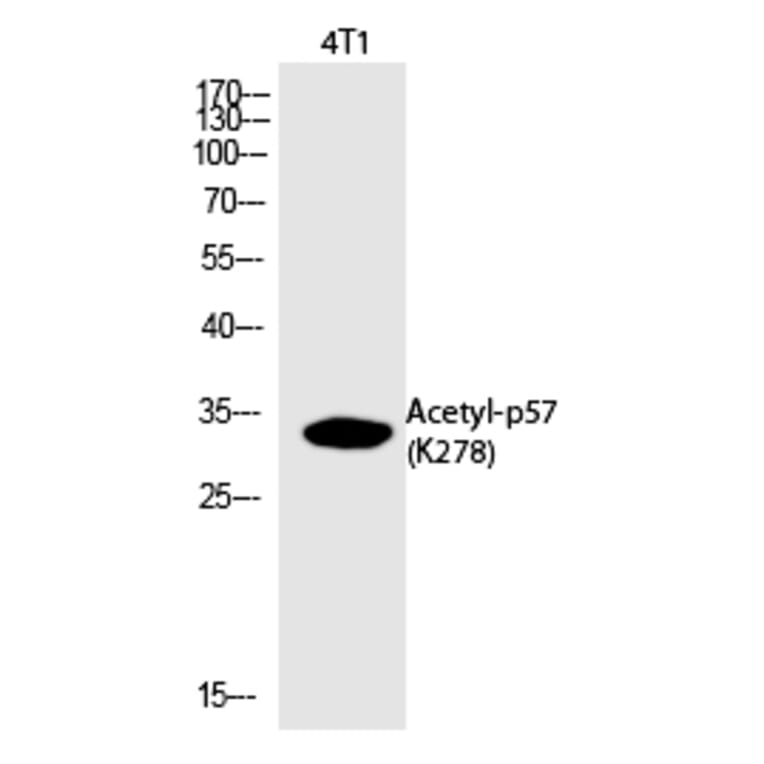 Western blot - p57 (Acetyl-Lys278) Polyclonal Antibody from Signalway Antibody (HW130) - Antibodies.com