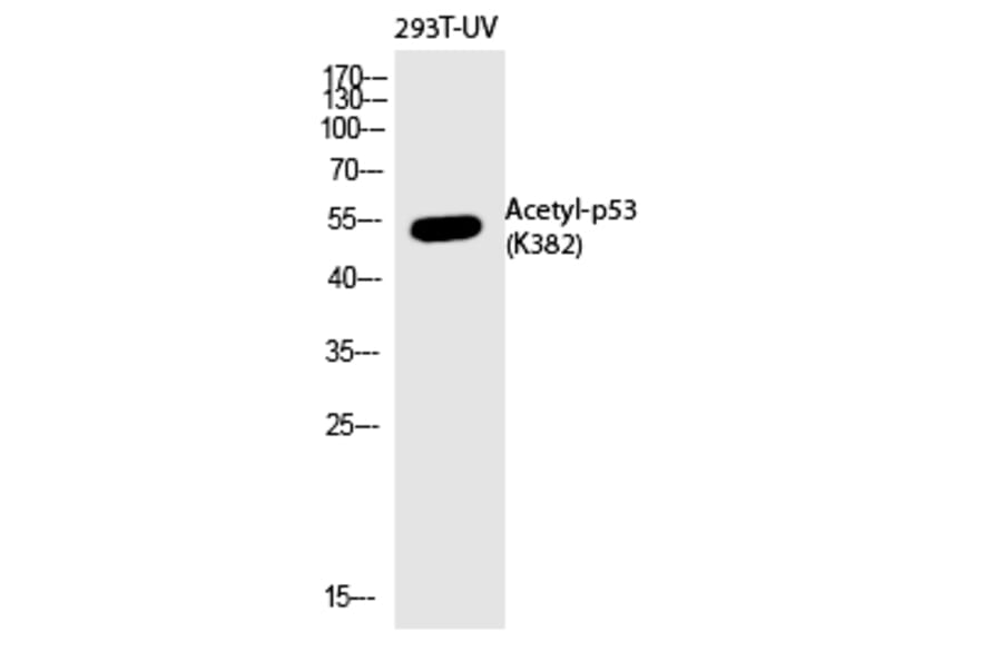 Western blot - p53 (Acetyl-Lys382) Polyclonal Antibody from Signalway Antibody (HW133) - Antibodies.com
