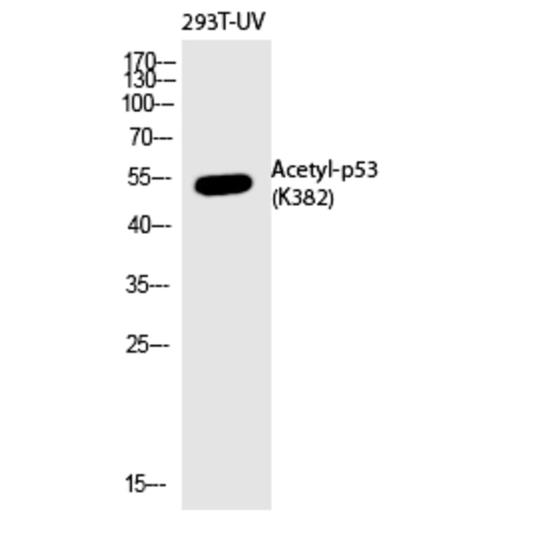 Western blot - p53 (Acetyl-Lys382) Polyclonal Antibody from Signalway Antibody (HW133) - Antibodies.com