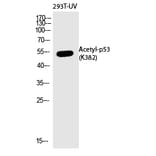 Western blot - p53 (Acetyl-Lys382) Polyclonal Antibody from Signalway Antibody (HW133) - Antibodies.com