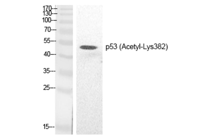 Western blot - p53 (Acetyl-Lys382) Polyclonal Antibody from Signalway Antibody (HW133) - Antibodies.com