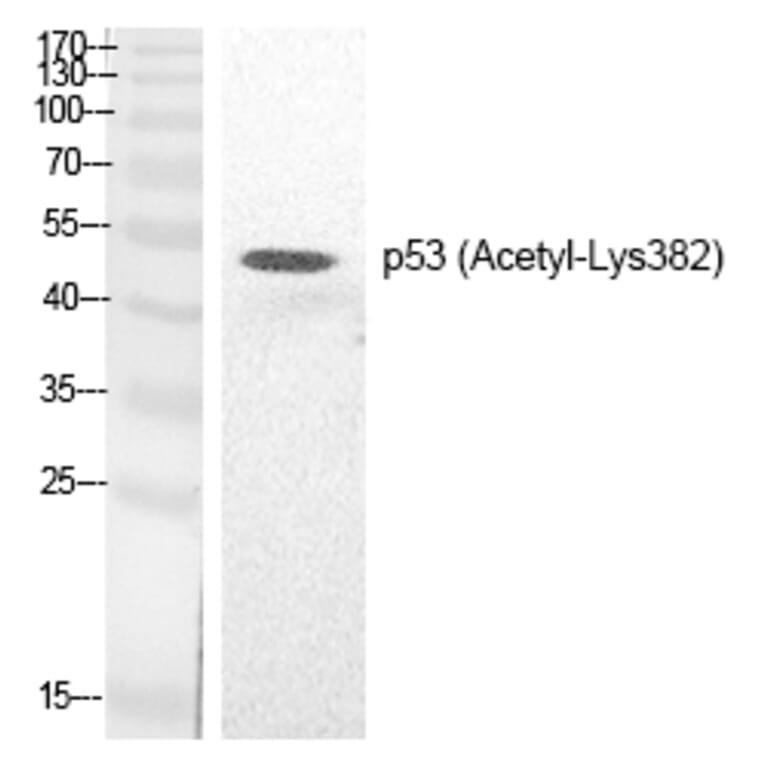 Western blot - p53 (Acetyl-Lys382) Polyclonal Antibody from Signalway Antibody (HW133) - Antibodies.com