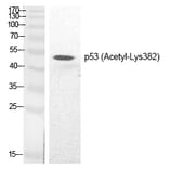 Western blot - p53 (Acetyl-Lys382) Polyclonal Antibody from Signalway Antibody (HW133) - Antibodies.com