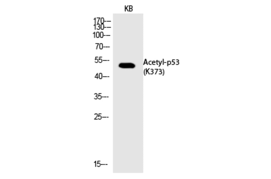 Western blot - p53 (Acetyl-Lys373) Polyclonal Antibody from Signalway Antibody (HW132) - Antibodies.com