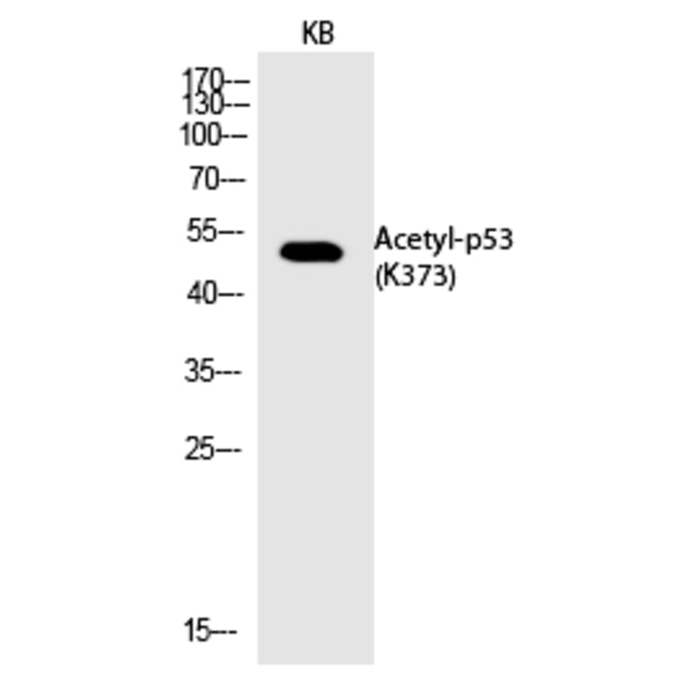 Western blot - p53 (Acetyl-Lys373) Polyclonal Antibody from Signalway Antibody (HW132) - Antibodies.com