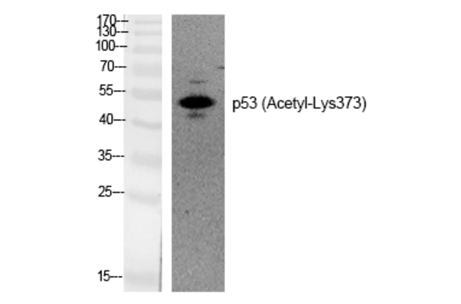 Western blot - p53 (Acetyl-Lys373) Polyclonal Antibody from Signalway Antibody (HW132) - Antibodies.com