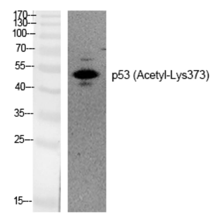 Western blot - p53 (Acetyl-Lys373) Polyclonal Antibody from Signalway Antibody (HW132) - Antibodies.com